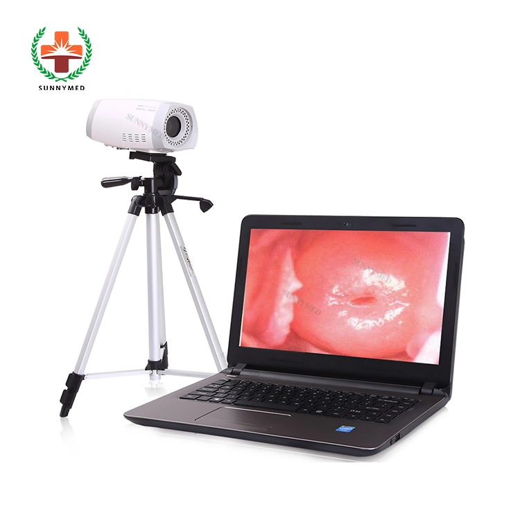 Sy-F003 Guangzhou Delivery Electronic Colposcope for Gynecologic Examination