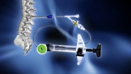 ドラゴンクラウン医療整形外科脊椎低侵襲手術器具